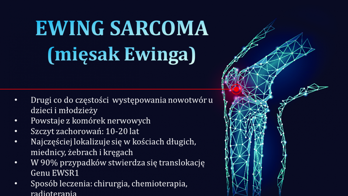 Nowotwory Kości Instytut Matki I Dziecka 4443